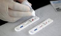 Covid-19: Estado deverá testar periodicamente todos os enfermeiros que atuam na linha de frente de combate à pandemia